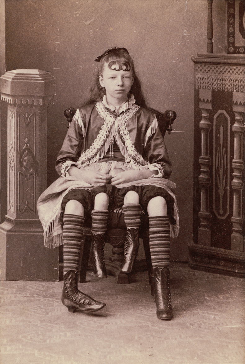Миртл  Корбин - четырехногая девочка из цирка, которая смогла найти свое счастье