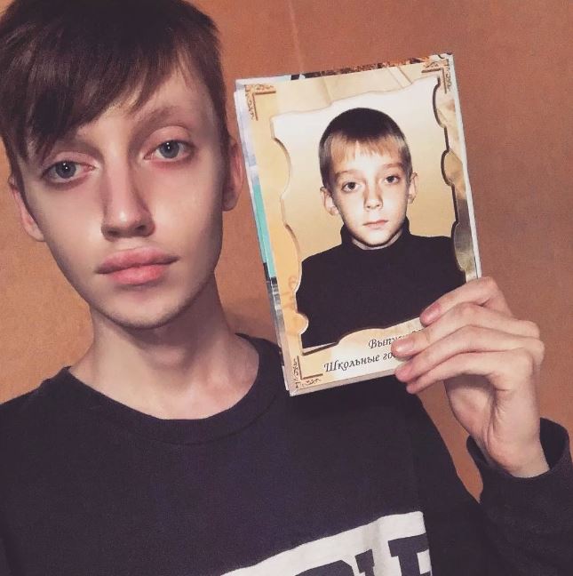 Обычный мальчишка. Как выглядел кумир молодежи Андрей Петров до пластики и славы
