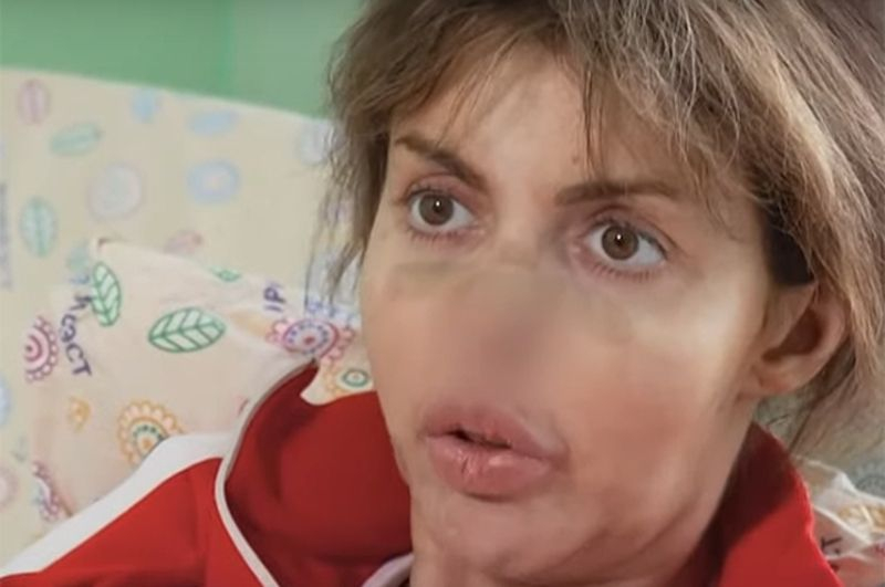 Носа больше нет. Куда пропала и как выглядит сейчас бывшая жена Аршавина