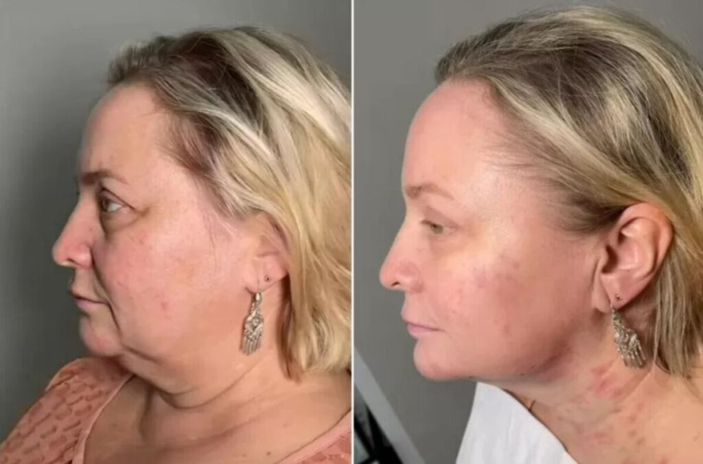 Светлану Пермякову не узнать! Актриса похудела на 10 кг и сделала пластику