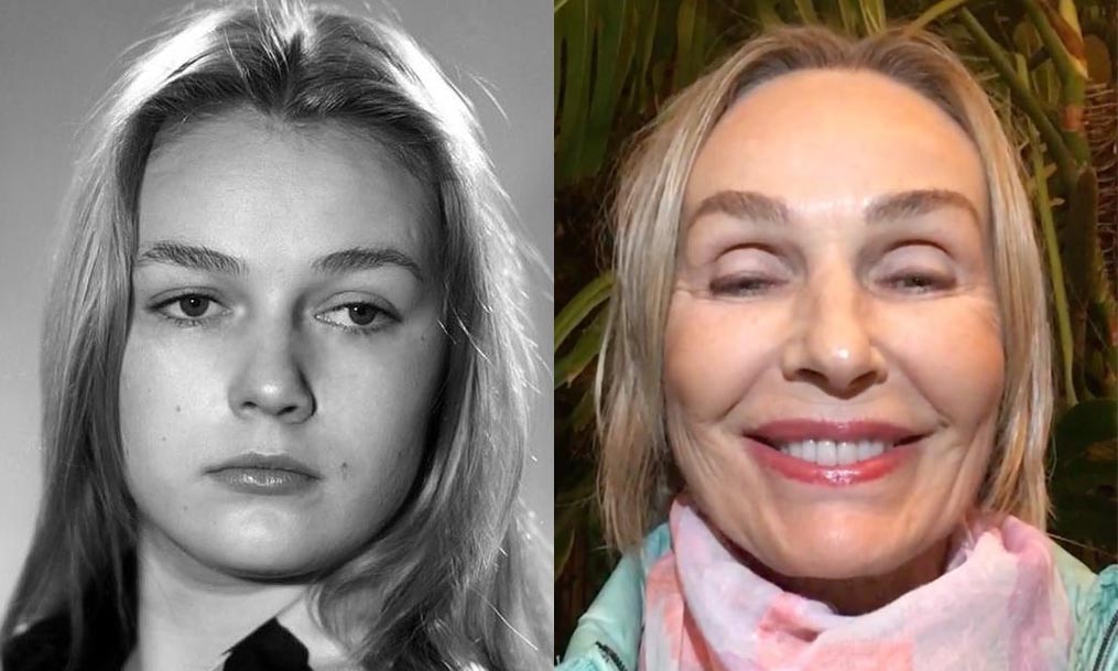Растянула лицо до ушей, а рот и вовсе перекосило: новое лицо 69-летней Андрейченко потрясло народ